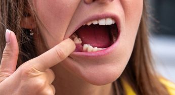 Addio alla dentiera, c’è un farmaco che fa ricrescere i denti!